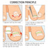 Ingrown Toenail Corrector Strips Brace - 10pcs/bottle - Straightener Clip for Thick Toenails