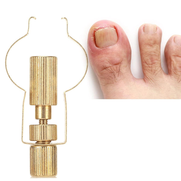 Ingrown Toenail Lifter Tool, Stainless Steel Professional Clamp for Ingrown Toenail Care, Paronychia (Gold)