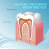 Teeth Whitening Pen, 5 Pens, 50+ Treatments, 35% Carbamide Peroxide Tooth Whitener Gel Brush