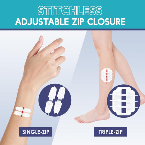 ZMZPA 32 2 Zip Stitch Wound Closure Strips, Pcs Laceration Closure Kit - Types Butterfly Bandages for Wound Closure