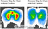 Tailbone, (GS1203-BLK) Tektrum Foldable Orthopedic Cool Gel Seat Cushion with Handle for Home, Office, Car, Chairs