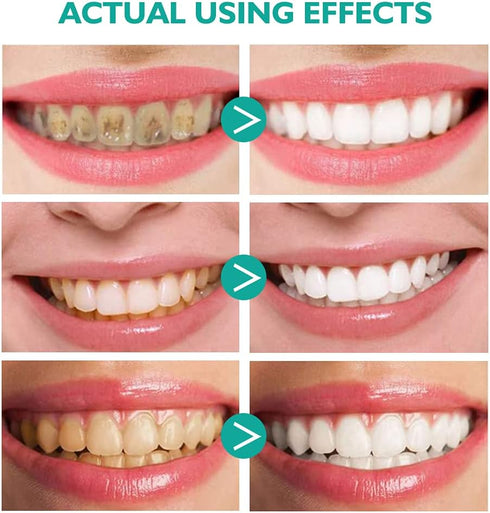Smddx 2PCS,Stain Foam Toothpaste Removal Toothpaste for Sensitive Teeth,Teeth foaming Whitening,Baking Soda Spearmint