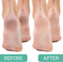 Maccibelle Foot Pumice and Scrubber for Feet and Heels, 3 Pack, Safely Eliminate Callus and Dead Skin