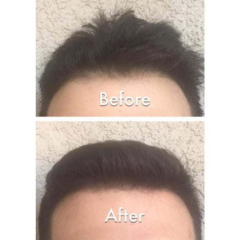 Keratin Hair Building Fibers, Natural Instant Hair Filler and Thickener for Men and Women - 25 grams