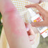 First Aid Burn Spray, Topical Numbing Spray with Lidocaine for Pain and Itch Relief of Minor Scalds and Burns – 2 Oz