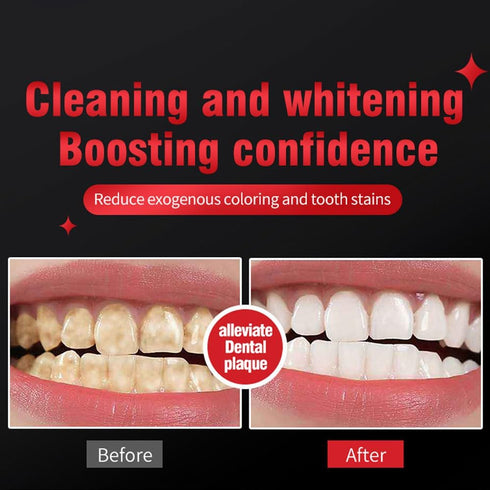 SP-6 6 4.9oz (2 Pack) Probiotic Whitening Toothpaste Advanced Formula with Probiotics for Teeth Whitening & Gum Health