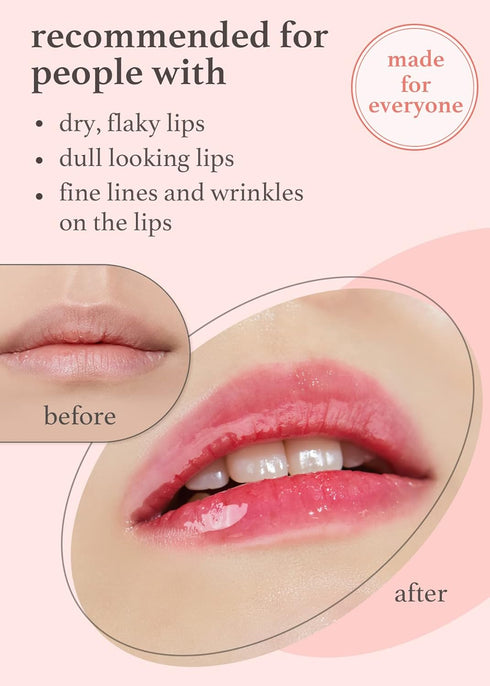 NOONI Korean Lip Oil - Applepeony, Long-Lasting Moisturizing Lip Stain for Dry Lips, Baby Pink Tint