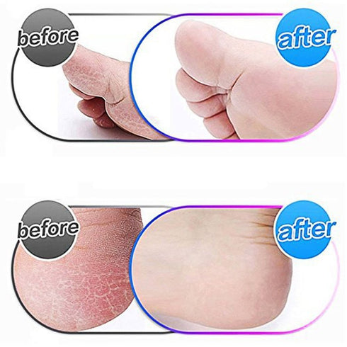 Jiumi 8 Pack Black Replacement Roller Refills Compatible with Scholl Express Pedi Foot Smoother-Extra Coarse
