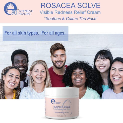 Rosacea Solve - Redness Relief Cream for Rosacea & Acne Prone Skin - Sensitive Skin Care with Organic Ingredients