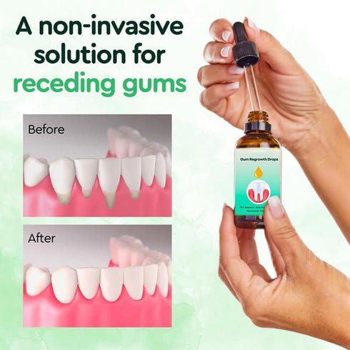 DentiZen Gum Relief Drops, 2Pcs Gum Treatment for Receding Gums, Oil Pulling for Teeth and Gums