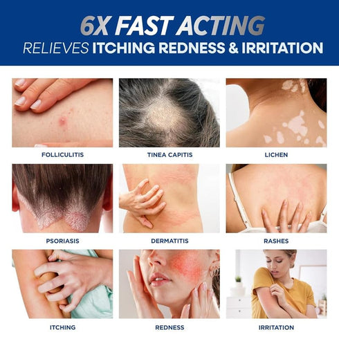 Hermon Folliculitis Treatment Cream & Antifungal Soap with Tea Tree Oil: Effective Treatment for Folliculitis Scalp