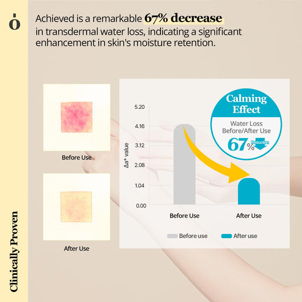 ONGREDIENTS Centella Asiatica Skin Barrier Calming Lotion, Vegan Korean Skin Care, 7.43 Fl Oz, Moisturizing for Dry Skin
