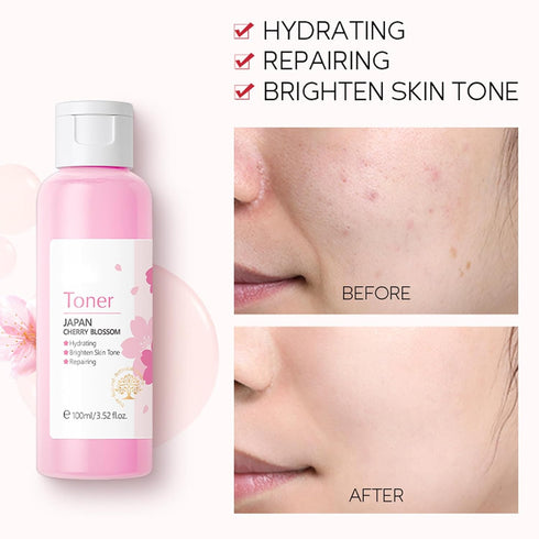 Sakura Face Care Set - 17Pcs Moisturizing Skin Care Routine with Cream, Cleanser, Serum, and Masks