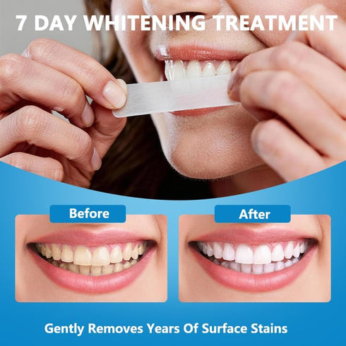 PLumeLux 7-Day 14 Teeth Whitening Strips Treatment Strips Mint Teeth Whitener Deep Tooth Stains Removal for Coffee