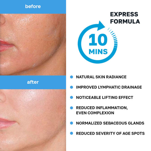 Name Skin Care Korean Carboxy CO2 Therapy Face & Neck Mask Set of 2 - Hydrating Anti-Aging Skincare Treatment