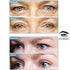 Original Eye Lift Kit, Small/Medium Size with Gel, Lifts Eyelid Droop and Hooded Eyes