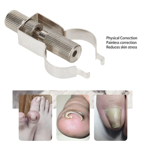 Ingrown Toenail Lifter Tool, Stainless Steel Clamp for Ingrown Toenail Care, Professional Foot Care Tool, Silver