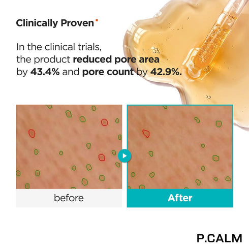P.CALM Retinolagen Ampoule 30ml | Vegan Fragrance-Free Skin Serum with Retinol, Vegan Collagen, Bakuchiol | Korean