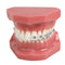 TM-208 Demonstration Orthodontic Model Teeth with Metal and Ceramic Bracket (Red)