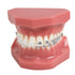 TM-208 Demonstration Orthodontic Model Teeth with Metal and Ceramic Bracket (Red)