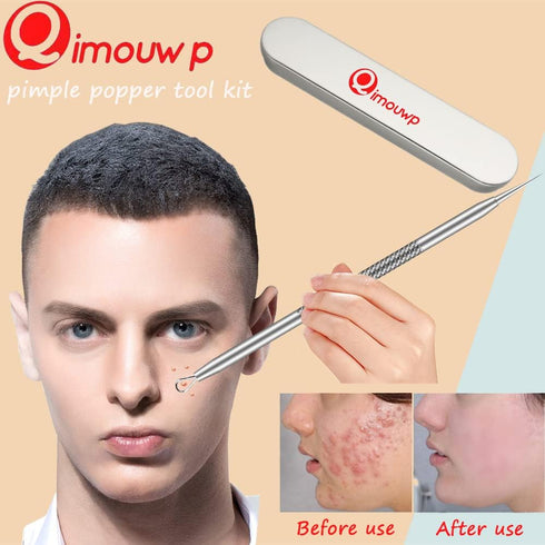 Pimple Popper Tool Kit, 16 PCS Professional Blackhead Remover Tools, Stainless Tweezers & Comedone Extractor