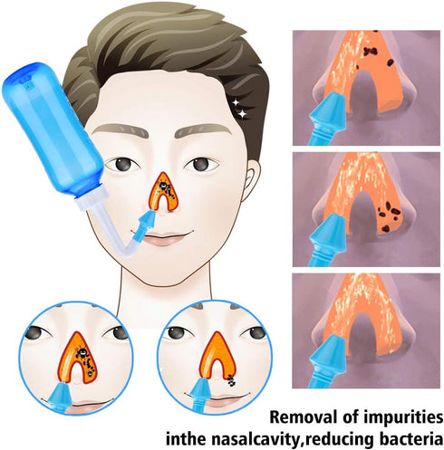 Carllg Neti Pot - Nasal Irrigation Wash Bottle with Sinus Rinse Salt for Adult & Kid (300ml with 30 Salt Packets)
