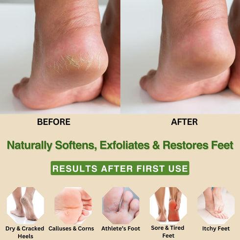 Peppermint + Rosemary, Eucalyptus & Tea Tree Foot Cream - Moisturizing Foot Lotion for Cracked Heel Repair (4 oz)
