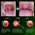 Airgoesin Upgraded Tonsil Stone Remove Tool + Irrigation Clean Syringe for Fresh Breath