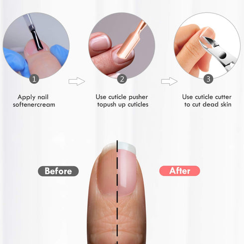 XUNXMAS Cuticle Trimmer and Remover with Pusher - Professional Stainless Steel Durable Pedicure Manicure Tools in Rose