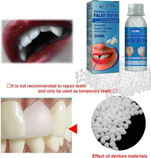 Yuehao 30Ml -1 New Temporary Tooth Temporary Repair Kit, DIY Play DoughSolidSimple-Temporary Fake Teeth Replacement Kit