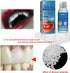Yuehao 30Ml -1 New Temporary Tooth Temporary Repair Kit, DIY Play DoughSolidSimple-Temporary Fake Teeth Replacement Kit
