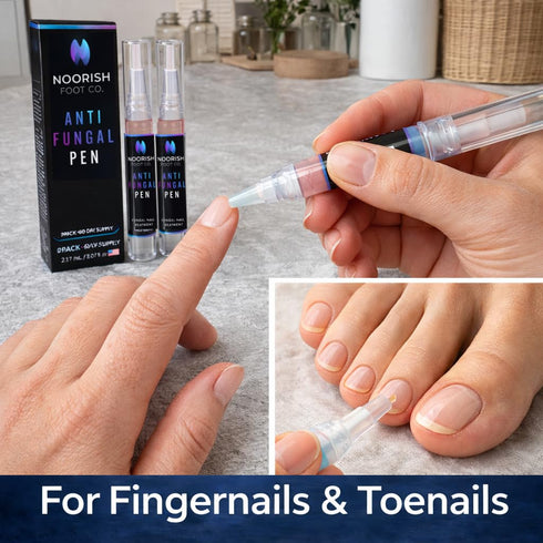 NOORISH FOOT CO. 2 Nail Fungus Treatment Pen for Toenails & Fingernails - Antifungal Nail Repair with Undecylenic Acid