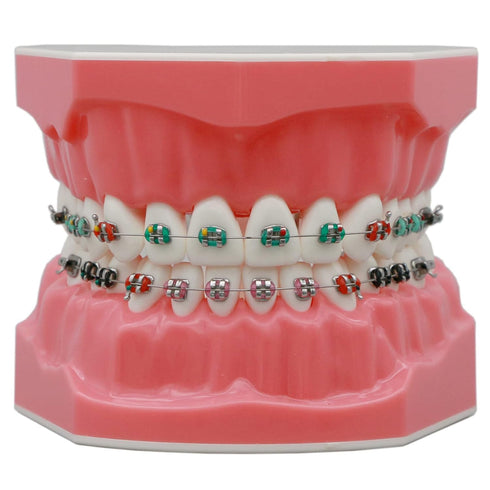 Dental Models Orthodontic Model M7010-2, 1:1 Standard Typodont Teeth with Archwire Ligature Ties, Metal Brackets