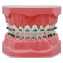 Dental Models Orthodontic Model M7010-2, 1:1 Standard Typodont Teeth with Archwire Ligature Ties, Metal Brackets