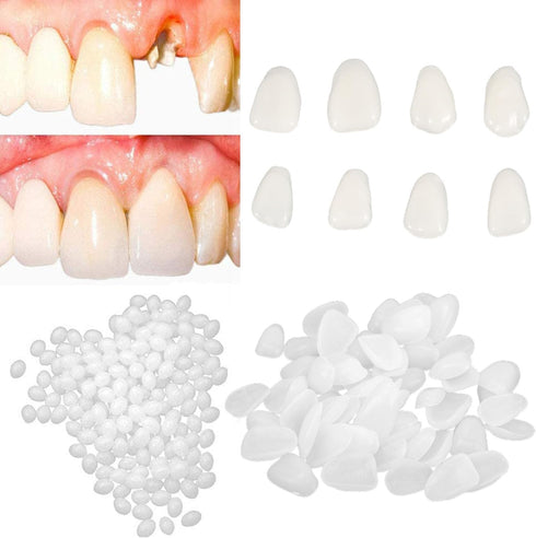 Fake Tooth Repair Kits for Filling Missing Broken Tooth and Gaps, Moldable Fake Teeth and Thermal Beads Replacement Kits