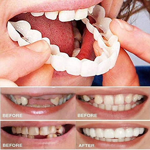 Fake Tooth Repair Kits for Filling Missing Broken Tooth and Gaps, Moldable Fake Teeth and Thermal Beads Replacement Kits