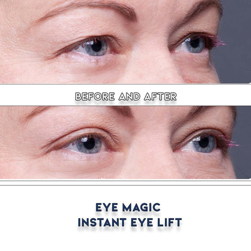 Original Eye Lift Kit, Small/Medium Size with Gel, Lifts Eyelid Droop and Hooded Eyes