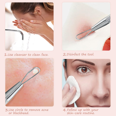 Professional Blackhead Remover Tool - 2-in-1 Stainless Steel Pimple Popper Blemish Extractor (2pcs)