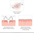 Clozex Emergency Laceration Kit - FDA Cleared Skin Closure Device for Wounds Up to 1.5 Inches