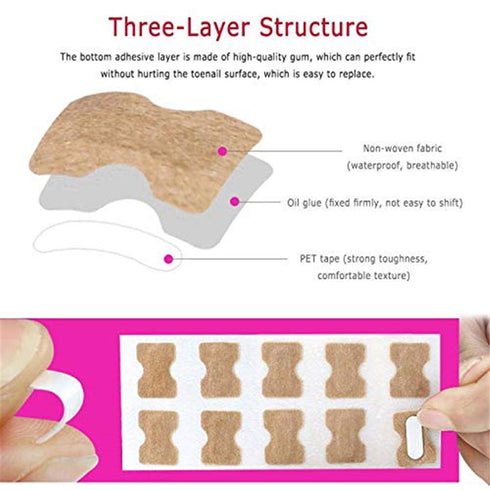 Ingrown Toenail Correction Patch, 50 Pcs Glue-free Stickers for Professional Foot Care