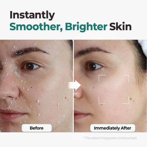 MOTHER MADE LHA Green Tea Exfoliating Aqua Peel Gel, Gentle Facial Exfoliant, Vegan Korean Skincare (100ml)