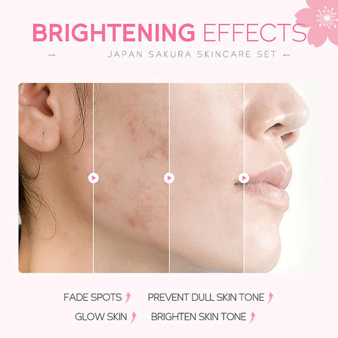 Skincare Gifts For Teenage Girls,Cherry Blossom Skincare Sets,Facial kit,Pamper Sets For Women Gifts,Skin Care Sets & Kits (SetA)