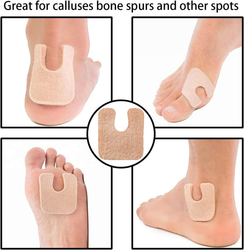 48 Pieces U Shaped Felt Callus Pads, Metatarsal Foot Pads for Pain Relief, Adhesive Pads for Men and Women