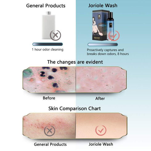 Intimate Hygiene Wash for Men Imported from Netherlands,pH Balance for Sensitive Skin,No Coloring Intimate Hygiene Wash