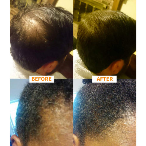 Keratin Hair Building Fibers, Natural Instant Hair Filler and Thickener for Men and Women - 25 grams