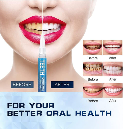 PankooTeeth 1-6 1-2 4 70+ Teeth Whitening Pen, Use Twice a Day Up to Shade Whiter in Weeks, No Sensitivity Pens