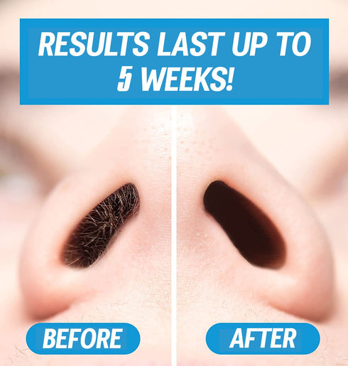 Nose Waxing Wax from Kenashii, 100g / 3.5 oz Hypoallergenic Wax for Nasal Hair Removal, Wipes Sold Separately