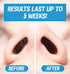 Nose Waxing Wax from Kenashii, 100g / 3.5 oz Hypoallergenic Wax for Nasal Hair Removal, Wipes Sold Separately
