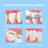 50PCS L-Shaped Interdental Brushes - Short Handle Dental Floss Brush with 5 Different Sizes for Braces