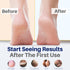 Yellow Bird Natural Foot Cream, Organic Athlete’s Foot Balm, Moisturizer for Heel Care & Callus Treatment
